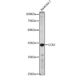 Western Blot - Anti-CCR2 Antibody (A11572) - Antibodies.com