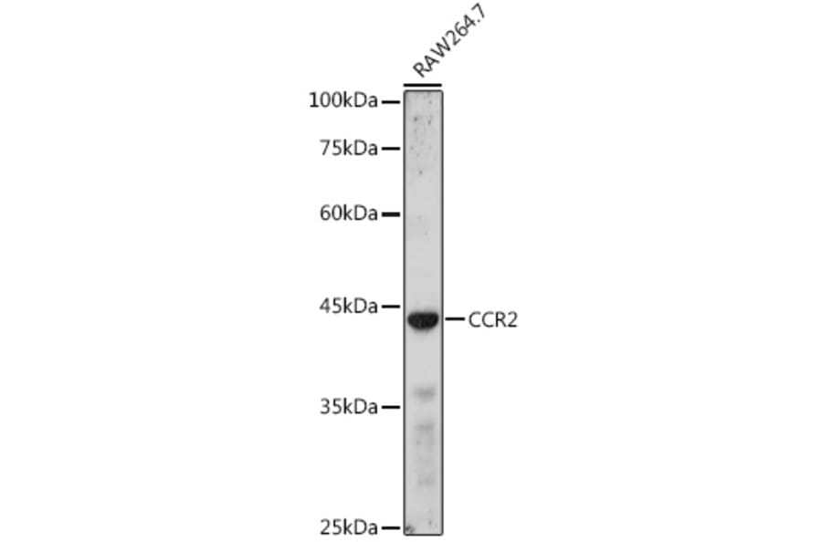 Western Blot - Anti-CCR2 Antibody (A11572) - Antibodies.com