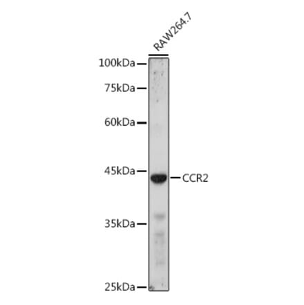 Western Blot - Anti-CCR2 Antibody (A11572) - Antibodies.com