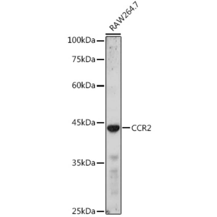 Western Blot - Anti-CCR2 Antibody (A11572) - Antibodies.com