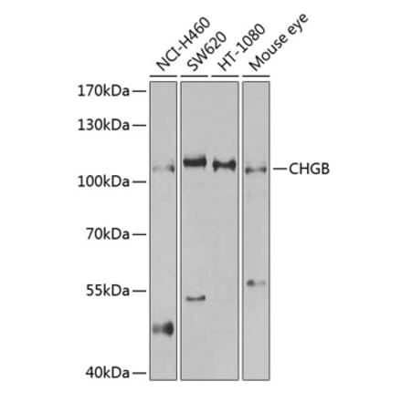 Western Blot - Anti-Chromogranin B Antibody (A11573) - Antibodies.com