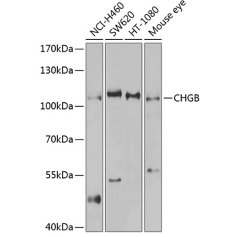 Western Blot - Anti-Chromogranin B Antibody (A11573) - Antibodies.com