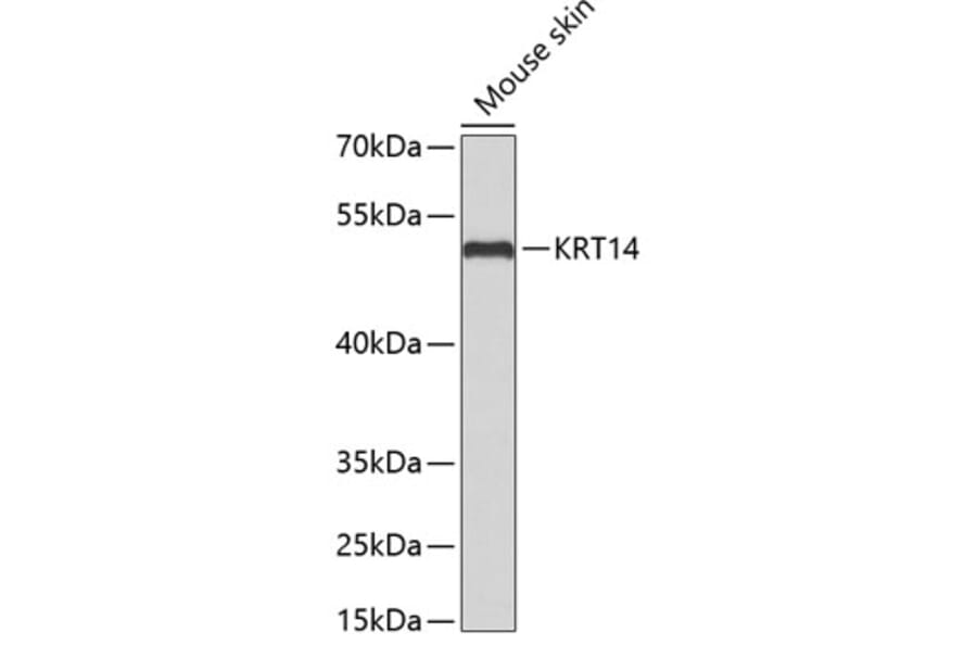 Western Blot - Anti-KRT14 Antibody (A2870) - Antibodies.com