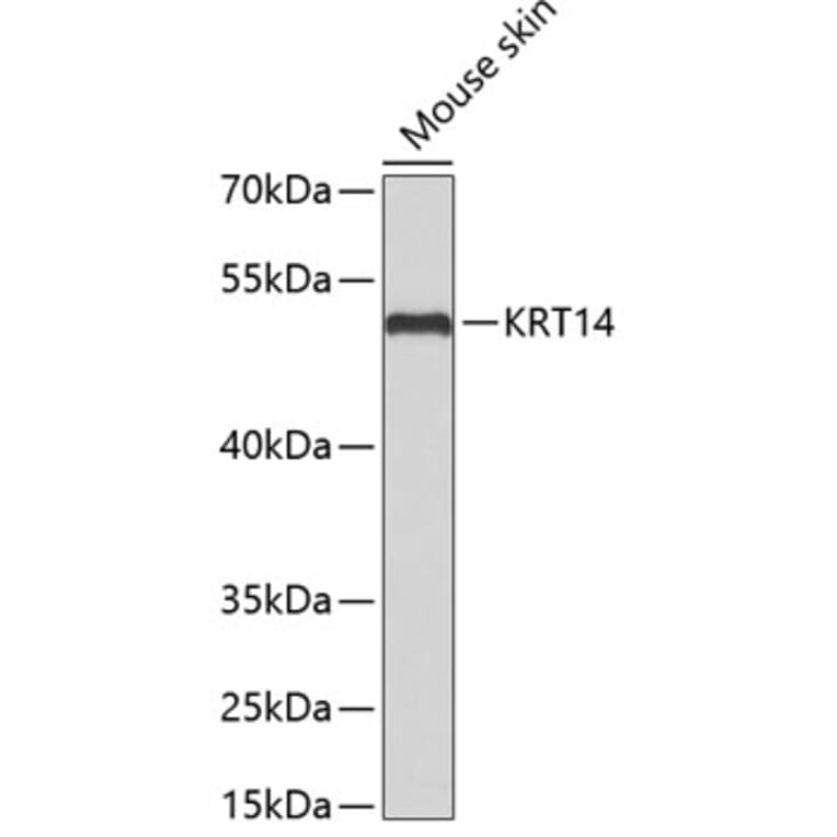 Western Blot - Anti-KRT14 Antibody (A2870) - Antibodies.com