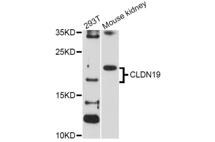 Western Blot - Anti-CLDN19 Antibody (A2874) - Antibodies.com