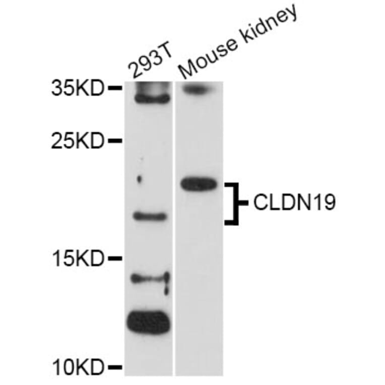 Western Blot - Anti-CLDN19 Antibody (A2874) - Antibodies.com