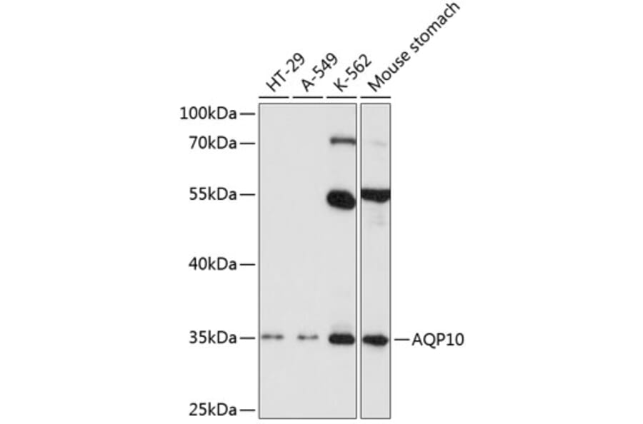 Western Blot - Anti-AQP-10 Antibody (A11578) - Antibodies.com