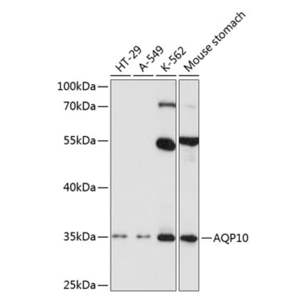 Western Blot - Anti-AQP-10 Antibody (A11578) - Antibodies.com