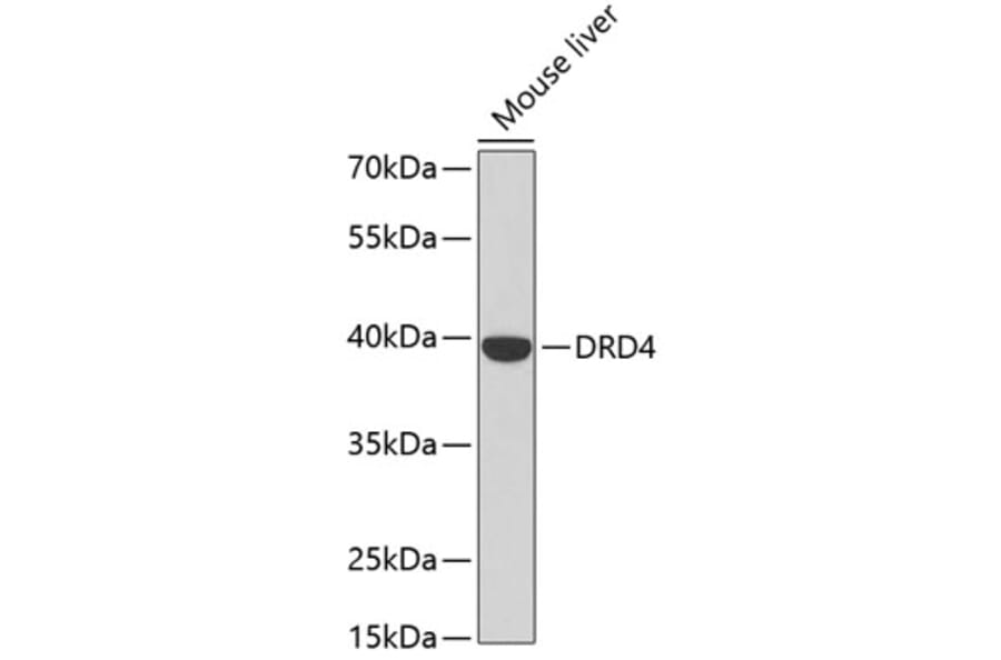 Western Blot - Anti-DRD4 Antibody (A2894) - Antibodies.com