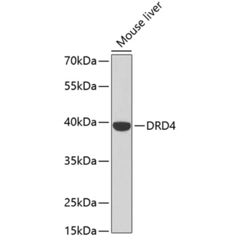 Western Blot - Anti-DRD4 Antibody (A2894) - Antibodies.com