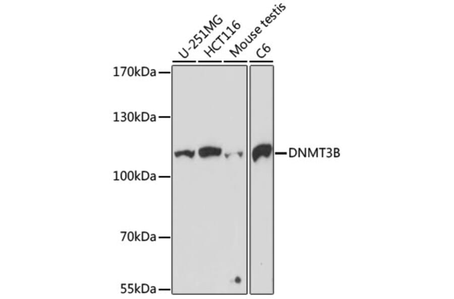 Western Blot - Anti-Dnmt3b Antibody (A11580) - Antibodies.com