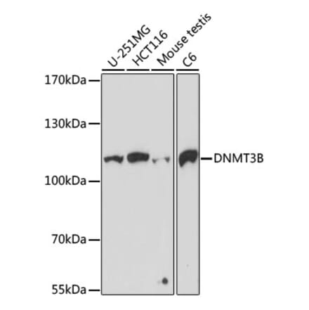 Western Blot - Anti-Dnmt3b Antibody (A11580) - Antibodies.com