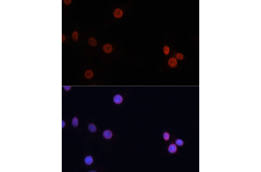 Immunofluorescence - Anti-Dnmt3b Antibody (A11580) - Antibodies.com
