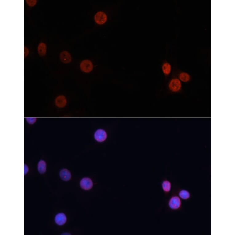 Immunofluorescence - Anti-Dnmt3b Antibody (A11580) - Antibodies.com