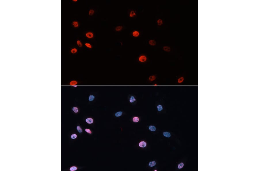 Immunofluorescence - Anti-Dnmt3b Antibody (A11580) - Antibodies.com