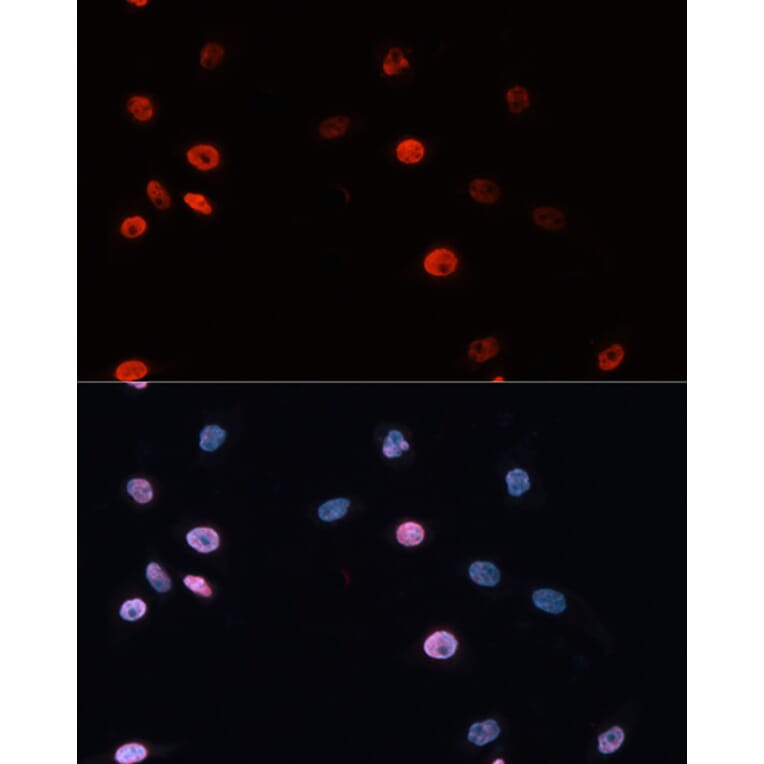 Immunofluorescence - Anti-Dnmt3b Antibody (A11580) - Antibodies.com