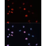 Immunofluorescence - Anti-Dnmt3b Antibody (A11580) - Antibodies.com