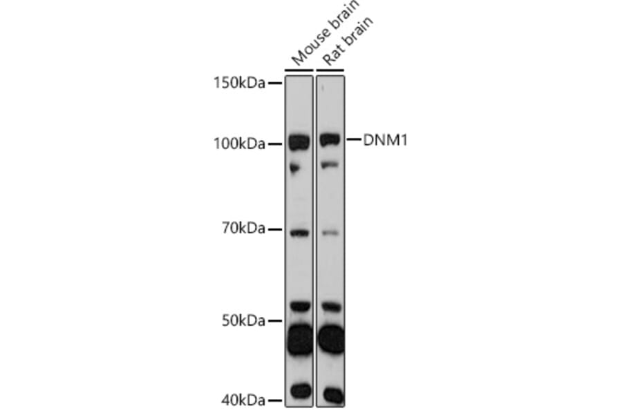 Western Blot - Anti-Dynamin 1 Antibody (A11581) - Antibodies.com