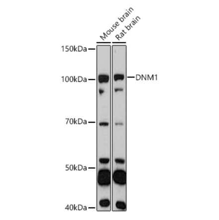 Western Blot - Anti-Dynamin 1 Antibody (A11581) - Antibodies.com