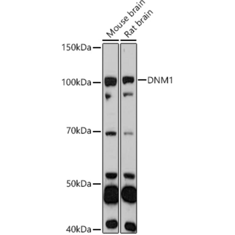 Western Blot - Anti-Dynamin 1 Antibody (A11581) - Antibodies.com