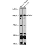Western Blot - Anti-Dynamin 1 Antibody (A11581) - Antibodies.com