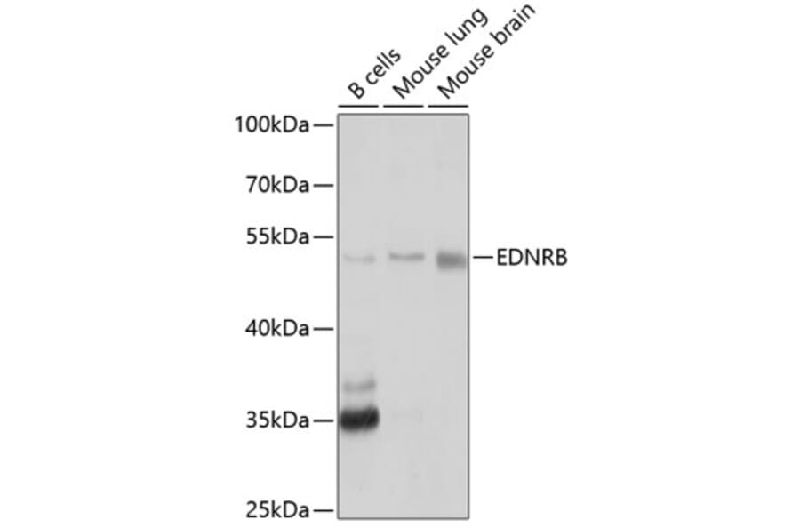 Western Blot - Anti-Endothelin B Receptor/ET-B Antibody (A11582) - Antibodies.com