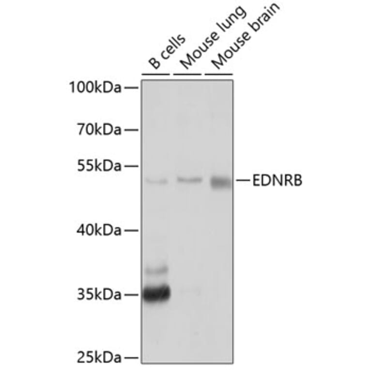 Western Blot - Anti-Endothelin B Receptor/ET-B Antibody (A11582) - Antibodies.com