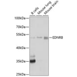 Western Blot - Anti-Endothelin B Receptor/ET-B Antibody (A11582) - Antibodies.com