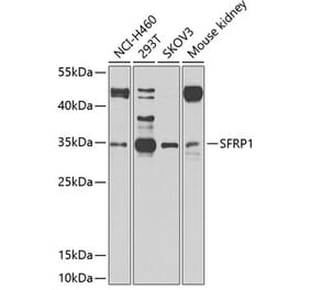 Western Blot - Anti-SFRP1 Antibody (A11583) - Antibodies.com