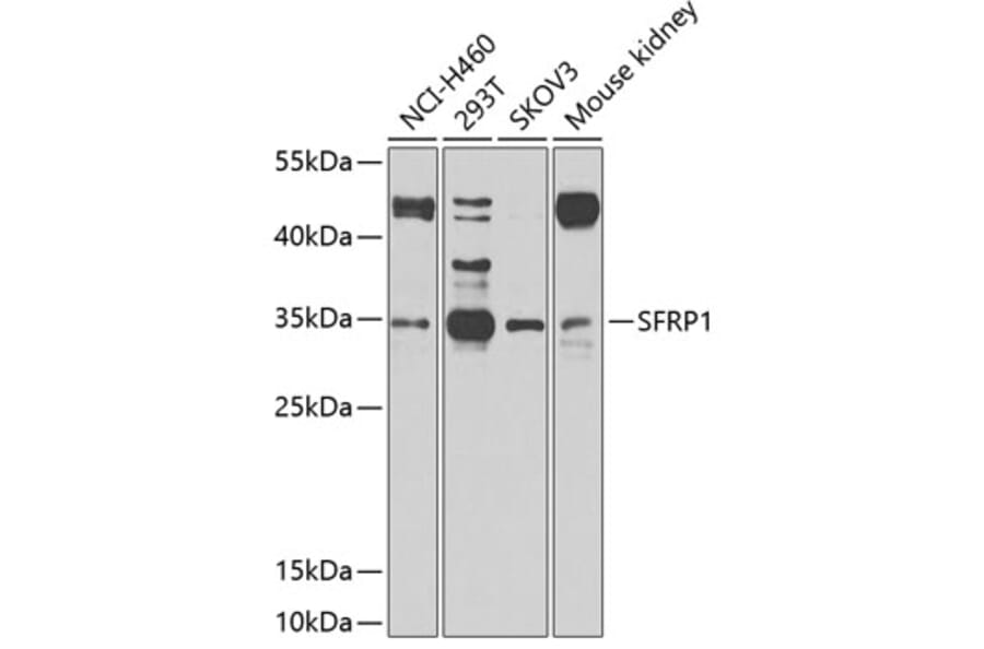 Western Blot - Anti-SFRP1 Antibody (A11583) - Antibodies.com
