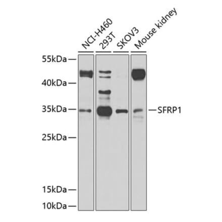 Western Blot - Anti-SFRP1 Antibody (A11583) - Antibodies.com