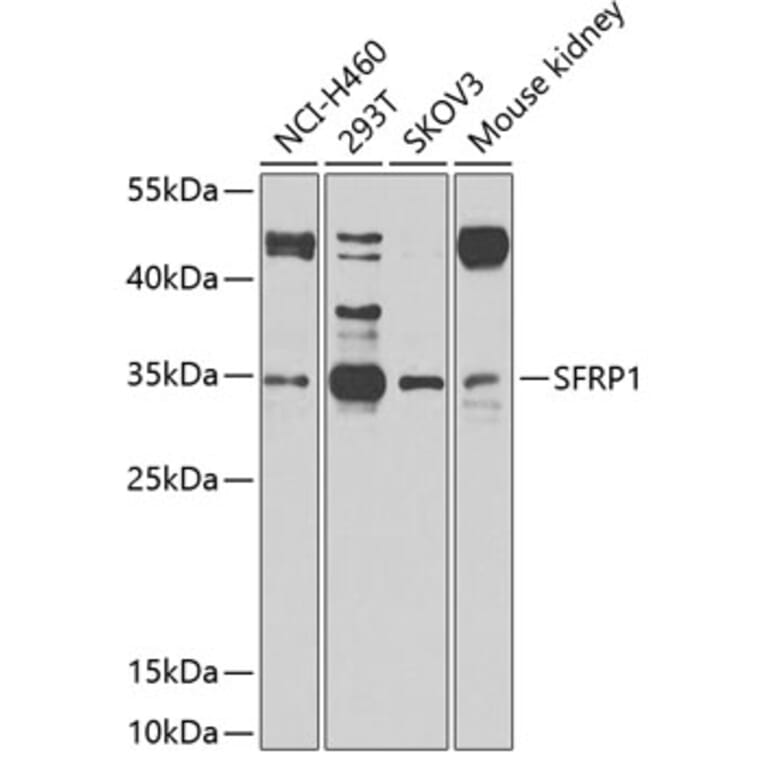 Western Blot - Anti-SFRP1 Antibody (A11583) - Antibodies.com