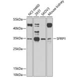 Western Blot - Anti-SFRP1 Antibody (A11583) - Antibodies.com