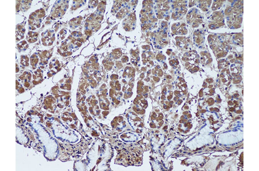Immunohistochemistry - Anti-SFRP1 Antibody (A11583) - Antibodies.com