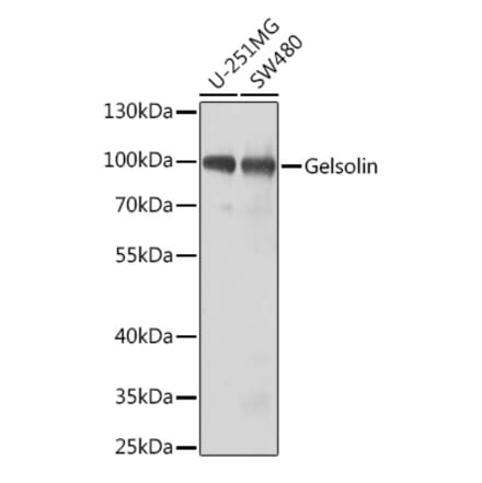 Western Blot - Anti-Gelsolin Antibody (A11587) - Antibodies.com