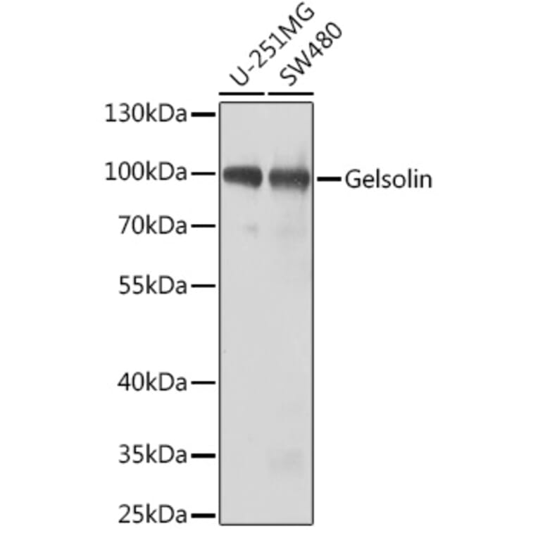 Western Blot - Anti-Gelsolin Antibody (A11587) - Antibodies.com