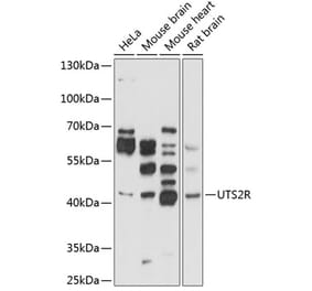 Western Blot - Anti-GPCR GPR14 Antibody (A11588) - Antibodies.com