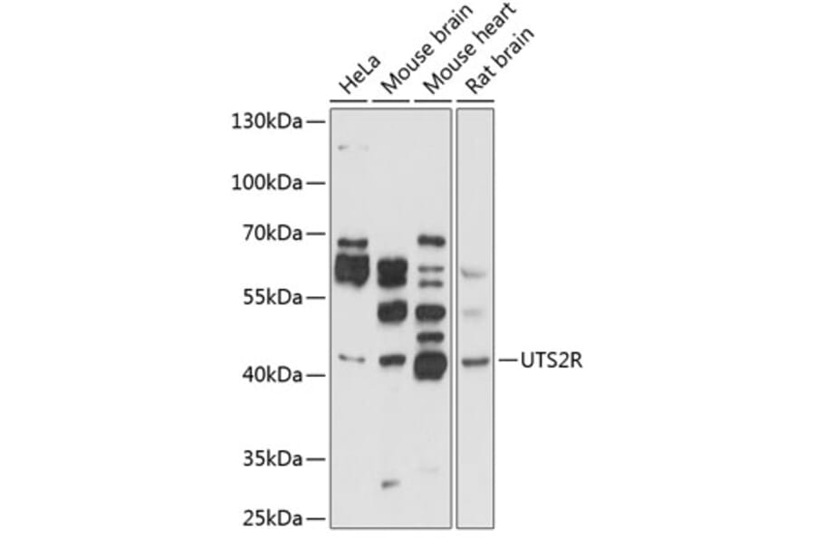 Western Blot - Anti-GPCR GPR14 Antibody (A11588) - Antibodies.com