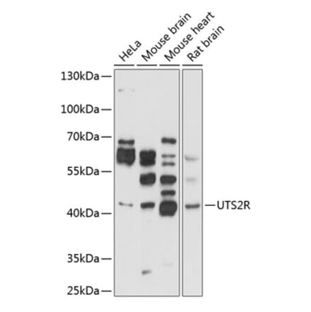 Western Blot - Anti-GPCR GPR14 Antibody (A11588) - Antibodies.com