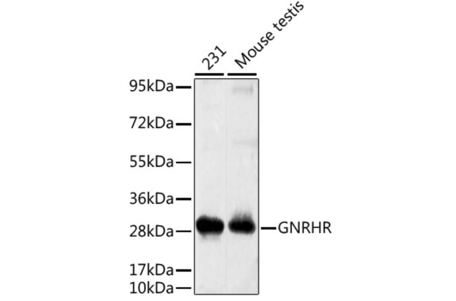 Western Blot - Anti-GNRHR Antibody (A2965) - Antibodies.com