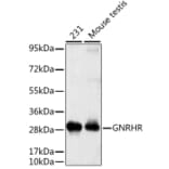 Western Blot - Anti-GNRHR Antibody (A2965) - Antibodies.com
