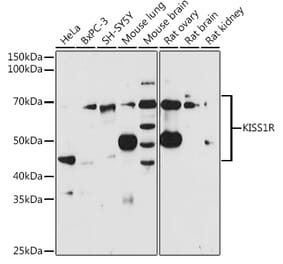 Western Blot - Anti-GPR54 Antibody (A11590) - Antibodies.com