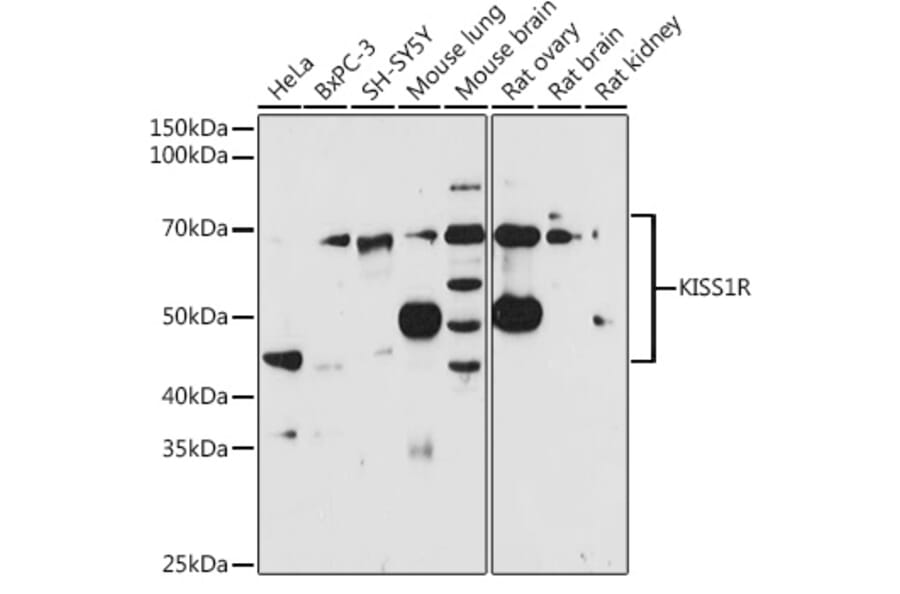 Western Blot - Anti-GPR54 Antibody (A11590) - Antibodies.com