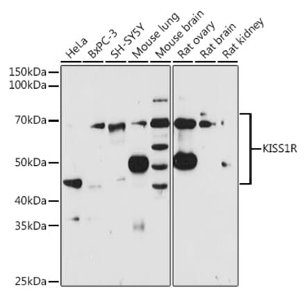 Western Blot - Anti-GPR54 Antibody (A11590) - Antibodies.com