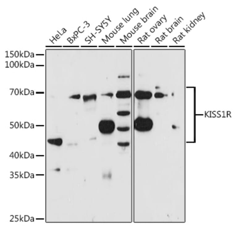 Western Blot - Anti-GPR54 Antibody (A11590) - Antibodies.com
