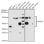 Western Blot - Anti-GPR54 Antibody (A11590) - Antibodies.com