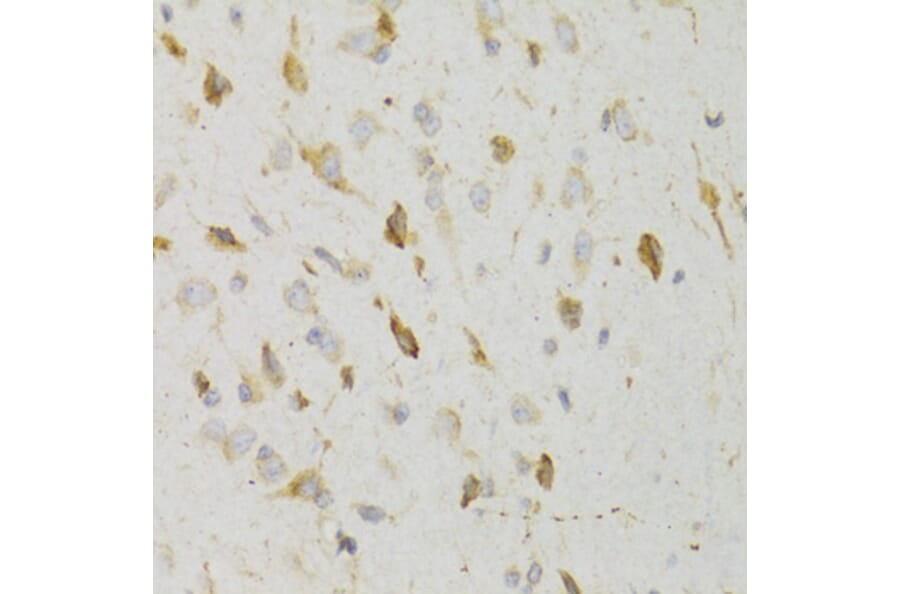 Immunohistochemistry - Anti-GPR54 Antibody (A11590) - Antibodies.com
