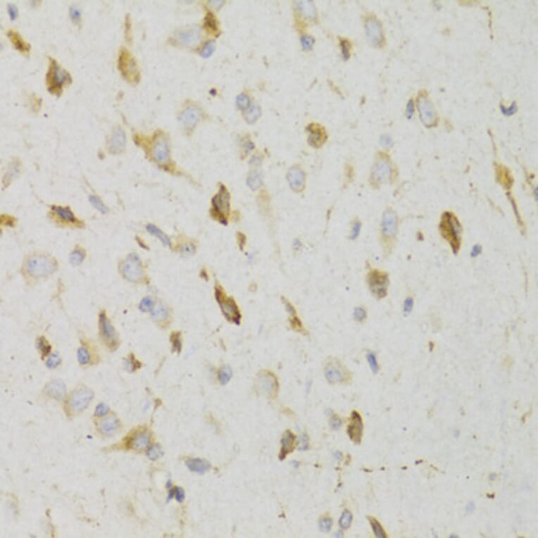 Immunohistochemistry - Anti-GPR54 Antibody (A11590) - Antibodies.com