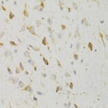 Immunohistochemistry - Anti-GPR54 Antibody (A11590) - Antibodies.com