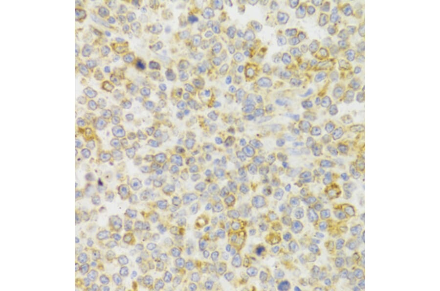 Immunohistochemistry - Anti-GPR54 Antibody (A11590) - Antibodies.com